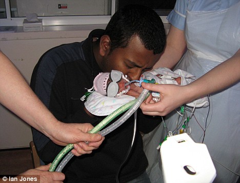 腦瘤引發(fā)腦溢血 英國女子死后兩天產(chǎn)下健康女嬰