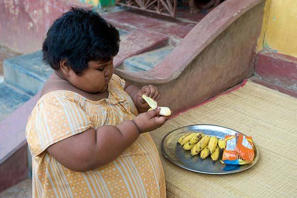 印度女孩5歲150斤醫(yī)生擔(dān)心活活吃死