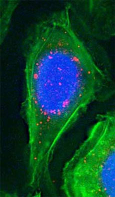 美宣布治療癌癥新突破 藥物穿“納米外衣”直達(dá)患處