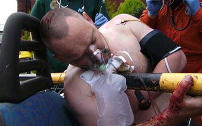 英司機(jī)被鐵桿穿胸 鎮(zhèn)定報(bào)警救援及時(shí)奇跡生還