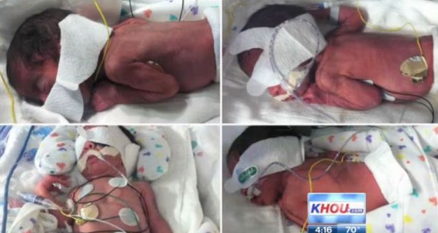 美國(guó)母親情人節(jié)生出兩組同卵雙胞胎 自然受孕率僅7000萬(wàn)分之一