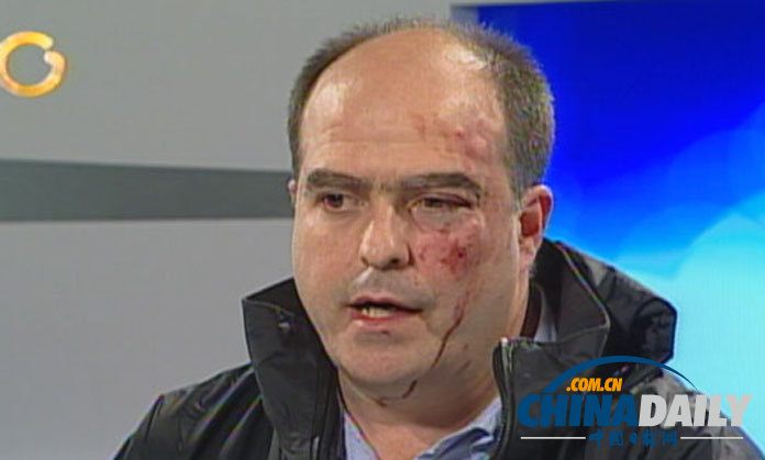 委內(nèi)瑞拉選后紛爭未息 朝野國會(huì)議員拳腳相向