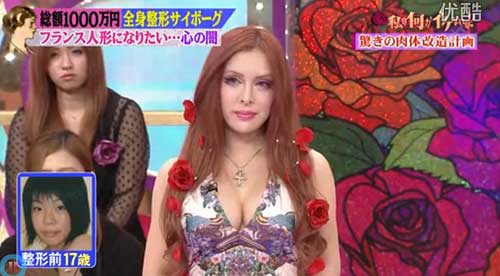 日本女?；?0萬美元整容30多次 欲成法式美女